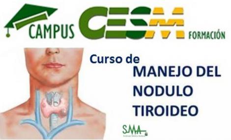Nuevo curso de Campus CESM: ”Conceptos clínicos básicos para el manejo del nódulo tiroideo”